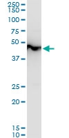 H00002023-A01 - Alpha-enolase / ENO1