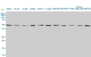 H00002026-M01 - Neuron specific enolase