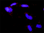 H00002034-D01P - HIF2A / HIF2 alpha