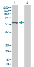 H00002035-D01P - EPB41 / Protein 4.1