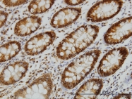 H00002035-M01 - EPB41 / Protein 4.1