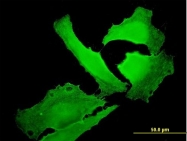 H00002035-M01 - EPB41 / Protein 4.1