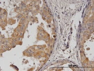 H00002064-M04 - CD340 / ERBB2 / HER2