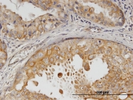 H00002064-M05 - CD340 / ERBB2 / HER2