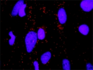 H00002064-M05 - CD340 / ERBB2 / HER2
