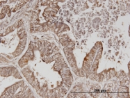 H00002065-M02 - ERBB3 / HER3
