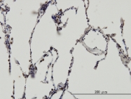 H00002079-M14 - ERH