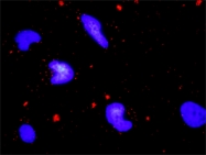 H00002081-M02 - ERN1 / IRE1