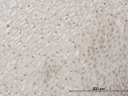 H00002081-M06 - ERN1 / IRE1