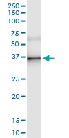 H00002098-D01 - Esterase D (ESD)