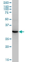 H00002098-M01 - Esterase D (ESD)