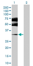H00002100-D01P - Estrogen receptor beta