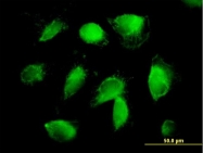H00002147-B01P - Prothrombin (F2)