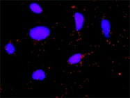 H00002147-M01 - Prothrombin (F2)