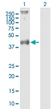 H00002149-B02P - Thrombin receptor / F2R