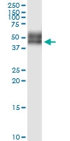 H00002152-D01 - CD142 / Tissue factor