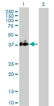 H00002152-D01P - CD142 / Tissue factor