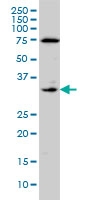 H00002152-M01 - CD142 / Tissue factor