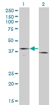 H00002152-M01 - CD142 / Tissue factor