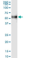 H00002155-D01 - Coagulation factor VII (F7)