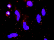 H00002155-D01P - Coagulation factor VII (F7)