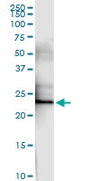 H00002157-D01 - Coagulation factor VIII (F8)