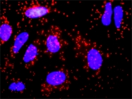 H00002157-M03 - Coagulation factor VIII (F8)