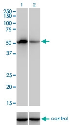 H00002158-M01 - Coagulation factor IX (F9)