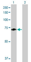 H00002160-B01P - Coagulation factor XI (F11)