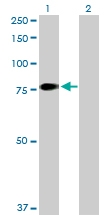 H00002160-D01P - Coagulation factor XI (F11)