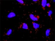 H00002161-M01 - Coagulation factor XII (F12)