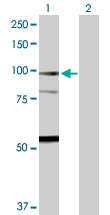 H00002162-D01P - Coagulation factor XIIIa (F13A1)