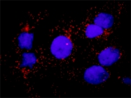 H00002162-M02 - Coagulation factor XIIIa (F13A1)
