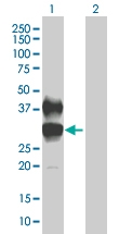 H00002204-B01 - CD89 / FCAR
