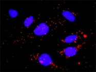 H00002209-M01 - CD64 / FCGR1A