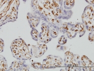 H00002213-M01 - CD32 / FcRII-a