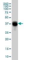H00002213-M01A - CD32B