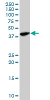 H00002237-A01 - FEN1 / RAD2