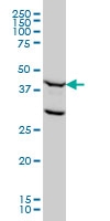 H00002237-M01A - FEN1 / RAD2