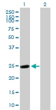H00002243-B02 - Fibrinogen alpha chain