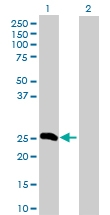 H00002243-D01P - Fibrinogen alpha chain