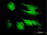 H00002246-B01P - FGF acidic / FGF1