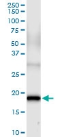 H00002246-D01 - FGF acidic / FGF1