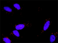 H00002246-D01P - FGF acidic / FGF1