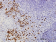 H00002246-M02 - FGF acidic / FGF1