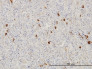 H00002246-M03 - FGF acidic / FGF1