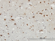 H00002257-M10 - FGF12