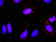 H00002266-M01 - Fibrinogen gamma chain