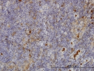 H00002268-M02 - FGR / SRC2