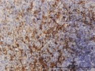 H00002308-M08 - FOXO1A